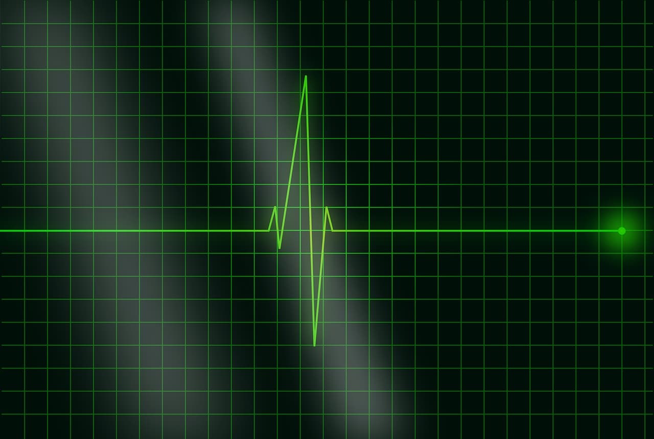 electrocardiogram, ecg, heartbeat
